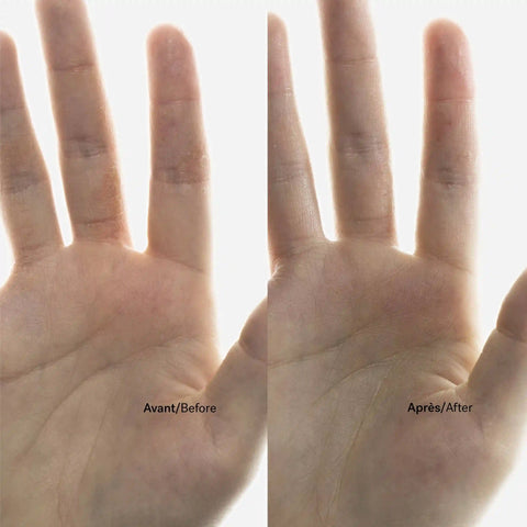 Atopic Skin Trio
